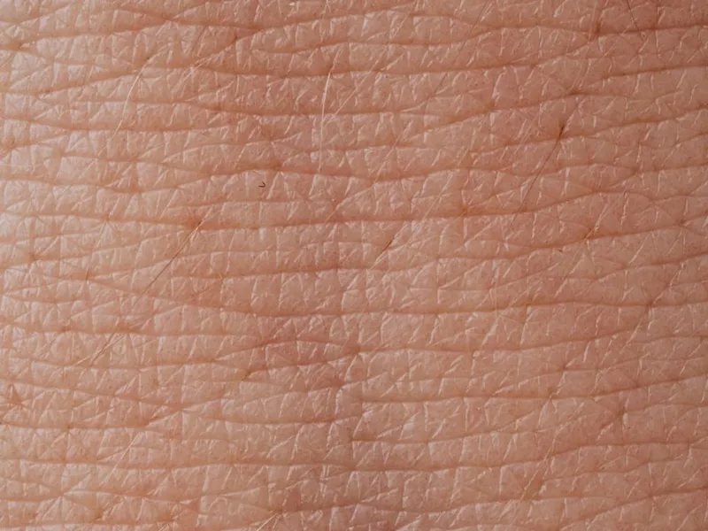 Tratamiento de Cicatrices